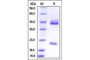 Human IL-23 alpha & IL-12 beta Heterodimer Protein on SDS-PAGE under reducing (R) condition.