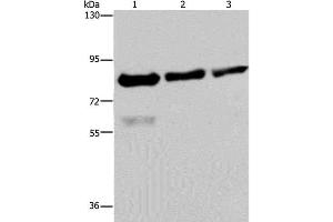 Western Blot analysis of Hela, LoVo and HepG2 cell using FASTKD2 Polyclonal Antibody at dilution of 1:500 (FASTKD2 antibody)