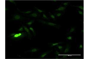 Immunofluorescence of monoclonal antibody to SUB1 on HeLa cell. (SUB1 antibody  (AA 32-124))