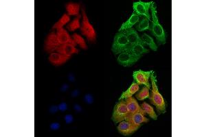 ABIN6263918 and ABIN6273062 staining Hela cells by IF/ICC. (OTUD7B antibody  (C-Term))