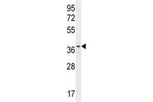 ZNF322B antibody western blot analysis in HL-60 lysate (ZNF322P1 antibody  (AA 326-354))