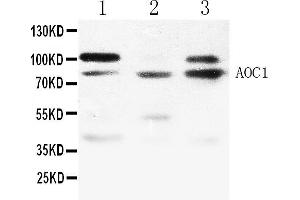 Western blot analysis of ABP1 expression in NRK whole cell lysates ( Lane 1), 293T whole cell lysates ( Lane 2) and MCF-7 whole cell lysates ( Lane 3). (DAO antibody  (N-Term))