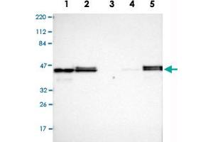 Western Blot analysis of Lane 1: RT-4, Lane 2: U-251MG sp, Lane 3: human plasma (IgG/HSA depleted), Lane 4: human liver and Lane 5: human tonsil lysates with VASP polyclonal antibody . (VASP antibody)