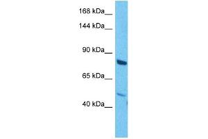 Host:  Rabbit  Target Name:  MAP3K1  Sample Tissue:  Human Jurkat Whole Cell  Antibody Dilution:  1ug/ml (MAP3K1 antibody  (C-Term))
