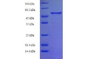 Malic Enzyme Complex, Mitochondrial (Mod2) (AA 1084-1419) protein (His-SUMO Tag)