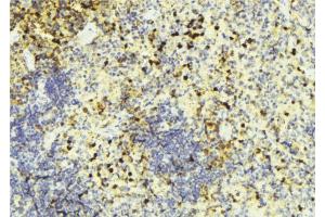 ABIN6274452 at 1/100 staining Mouse liver tissue by IHC-P.