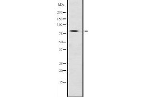 Western blot analysis of NFE2L1 expression in Mouse testis lysate,The lane on the left is treated with the antigen-specific peptide.