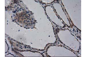 Immunohistochemical staining of paraffin-embedded Human thyroid tissue using anti-EIF4E2 mouse monoclonal antibody. (EIF4E2 antibody)