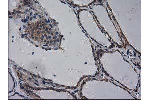 Immunohistochemical staining of paraffin-embedded Human thyroid tissue using anti-EIF4E2 mouse monoclonal antibody.