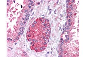Immunohistochemistry (IHC) image for anti-Signal Transducer and Activator of Transcription 3 (Acute-Phase Response Factor) (STAT3) (N-Term) antibody (ABIN2780479) (STAT3 antibody  (N-Term))