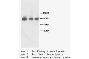 Image no. 2 for anti-Fibroblast Growth Factor Receptor 2 (FGFR2) (C-Term) antibody (ABIN1493068) (FGFR2 antibody  (C-Term))