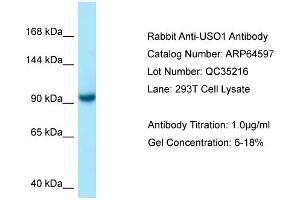 Western Blotting (WB) image for anti-USO1 Homolog, Vesicle Docking Protein (USO1) (C-Term) antibody (ABIN2789890) (USO1 antibody  (C-Term))