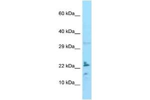 WB Suggested Anti-IL24 Antibody Titration: 1. (IL-24 antibody  (C-Term))