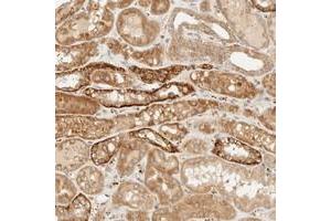 Immunohistochemical staining of human kidney with KLF17 polyclonal antibody  shows strong cytoplasmic positivity in distal tubules at 1:200-1:500 dilution.