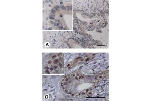 BSP antibody