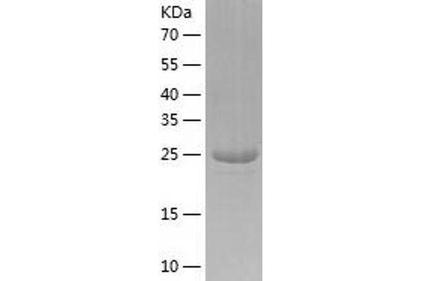 Polybromo 1 Protein (PBRM1) (AA 53-345) (His tag)