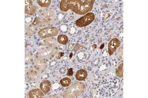 Immunohistochemical staining of human kidney with ZNF205 polyclonal antibody  shows cytoplasmic positivity in cells in tubules at 1:20-1:50 dilution.