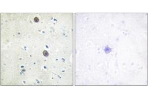 Immunohistochemistry analysis of paraffin-embedded human brain, using Amyloid beta A4 (Phospho-Thr743/668) Antibody. (APP antibody  (pThr743))