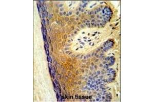 Formalin-fixed and paraffin-embedded human skin tissue reacted with ALOX15B Antibody (C-term) (ABIN653147 and ABIN2842719) ,which was peroxidase-conjugated to the secondary antibody, followed by DAB staining. (ALOX15B antibody  (C-Term))