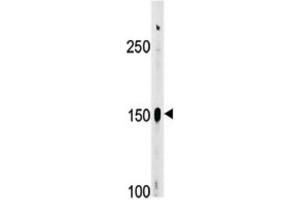 Western Blotting (WB) image for anti-C-Abl Oncogene 1, Non-Receptor tyrosine Kinase (ABL1) (pTyr412) antibody (ABIN3001744)