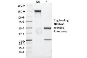 SDS-PAGE Analysis Purified CD30 Monoclonal Antibody (Ki-1/779). (TNFRSF8 antibody)