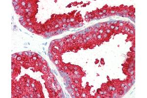 Anti-ELMO3 antibody IHC staining of human prostate.