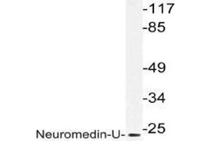 Western blot (WB) analysis of Neuromedin-U in extracts from HepG2 cells with AP21204PU-N.