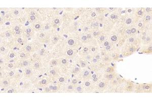 Detection of C8b in Mouse Liver Tissue using Polyclonal Antibody to Complement Component 8b (C8b) (C8B antibody  (AA 161-503))