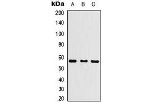 Western blot analysis of Cytochrome P450 26C1 expression in HEK293T (A), Raw264.