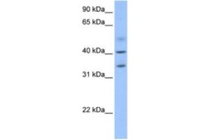 Western Blotting (WB) image for anti-Zinc Finger CCCH-Type Containing 14 (ZC3H14) antibody (ABIN2463623) (ZC3H14 antibody)