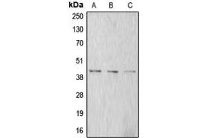 Western blot analysis of Alpha-actin-1 expression in A549 (A), SP2/0 (B), rat kidney (C) whole cell lysates. (Actin antibody  (N-Term))