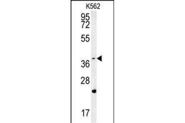 FBXW12 抗体  (C-Term)
