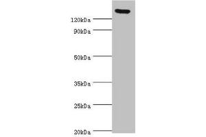 Western blot All lanes: SPAG5 antibody at 2 μg/mL Secondary Goat polyclonal to rabbit IgG at 1/10000 dilution Predicted band size: 134 kDa Observed band size: 134 kDa (SPAG5 antibody  (AA 1-300))