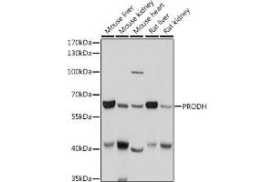 Western blot analysis of extracts of various cell lines, using PRODH antibody (ABIN6128506, ABIN6146242, ABIN6146243 and ABIN6221531) at 1:1000 dilution. (PRODH antibody  (AA 321-600))