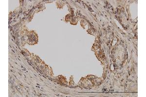 Immunoperoxidase of monoclonal antibody to PAK1 on formalin-fixed paraffin-embedded human prostate. (PAK1 antibody  (AA 191-280))