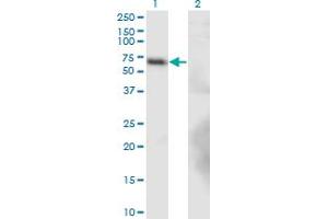 Western Blot analysis of BTBD9 expression in transfected 293T cell line by BTBD9 monoclonal antibody (M02), clone 1G3. (BTBD9 antibody  (AA 2-70))