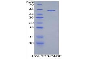 SDS-PAGE of Protein Standard from the Kit (Highly purified E. (Amphiregulin ELISA Kit)