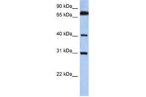 DHRSX antibody used at 0. (DHRSX antibody  (C-Term))