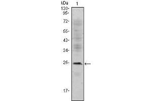 Western Blot showing CD3E antibody used against Jurkat (1) cell lysate. (CD3 epsilon antibody)