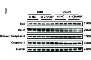 CRAMP is reduced in cardiac ischemia/reperfusion (I/R) injury and prevents cardiomyocyte apoptosis. (BAX antibody  (AA 1-100))