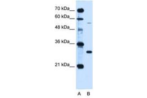 Image no. 2 for anti-Hemochromatosis (HFE) (AA 149-198) antibody (ABIN6736669) (HFE antibody  (AA 149-198))