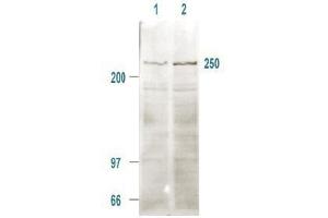 Immunoblotting. (MTOR antibody  (pSer2448))