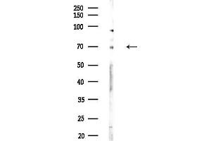 anti-Core-binding Factor, Runt Domain, alpha Subunit 2, Translocated To, 3 (CBFA2T3) (N-Term) antibody