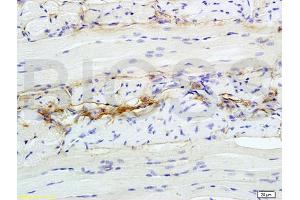 Formalin-fixed and paraffin embedded rat tongue tissue labeled with Anti-CD47 MER6 Polyclonal Antibody, unconjugated  (ABIN739530)  at 1: 200  followed by incubation with conjugated secondary antibody