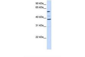 SLC25A16 antibody  (AA 218-267)