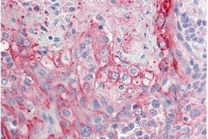 ABIN571241 (5µg/ml) staining of paraffin embedded Human Tonsil. (RHCG antibody  (Internal Region))