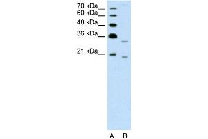 WB Suggested Anti-DNASE2B Antibody Titration:  1. (DNASE2B antibody  (C-Term))
