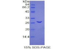 SDS-PAGE (SDS) image for Transmembrane Protein 173 (TMEM173) (AA 160-363) protein (His tag) (ABIN2127073)