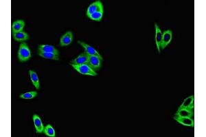 Immunofluorescent analysis of HepG2 cells using ABIN7172930 at dilution of 1:100 and Alexa Fluor 488-congugated AffiniPure Goat Anti-Rabbit IgG(H+L) (Tetraspanin 7 antibody  (AA 114-184))