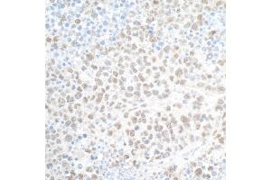 Immunohistochemistry (IHC) image for anti-PHD Finger Protein 8 (PHF8) (AA 650-700) antibody (ABIN7454781) (PHF8 antibody  (AA 650-700))